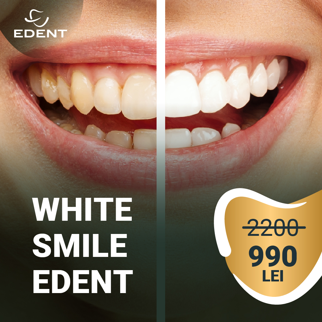 https://edentclinic.ro/wp-content/uploads/2022/05/1-Pachet-White-Smile-Edent.jpg
