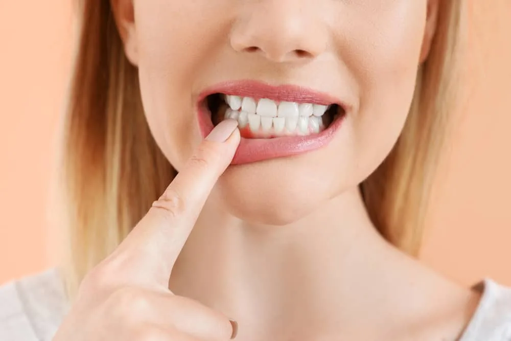 sangerari-gingivale-cauze